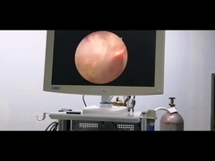 Rf-Plasma-Chirurgie-System-Urologie-Elektrode für gutartige Prostatahyperplasie